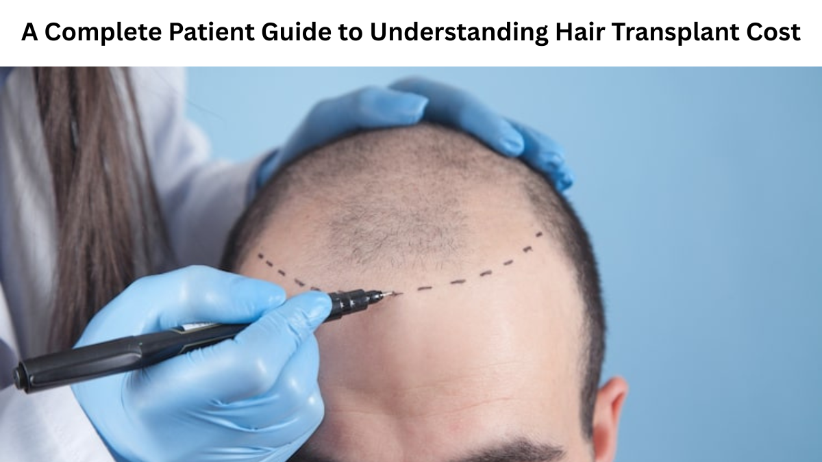 A Complete Patient Guide to Understanding Hair Transplant Cost