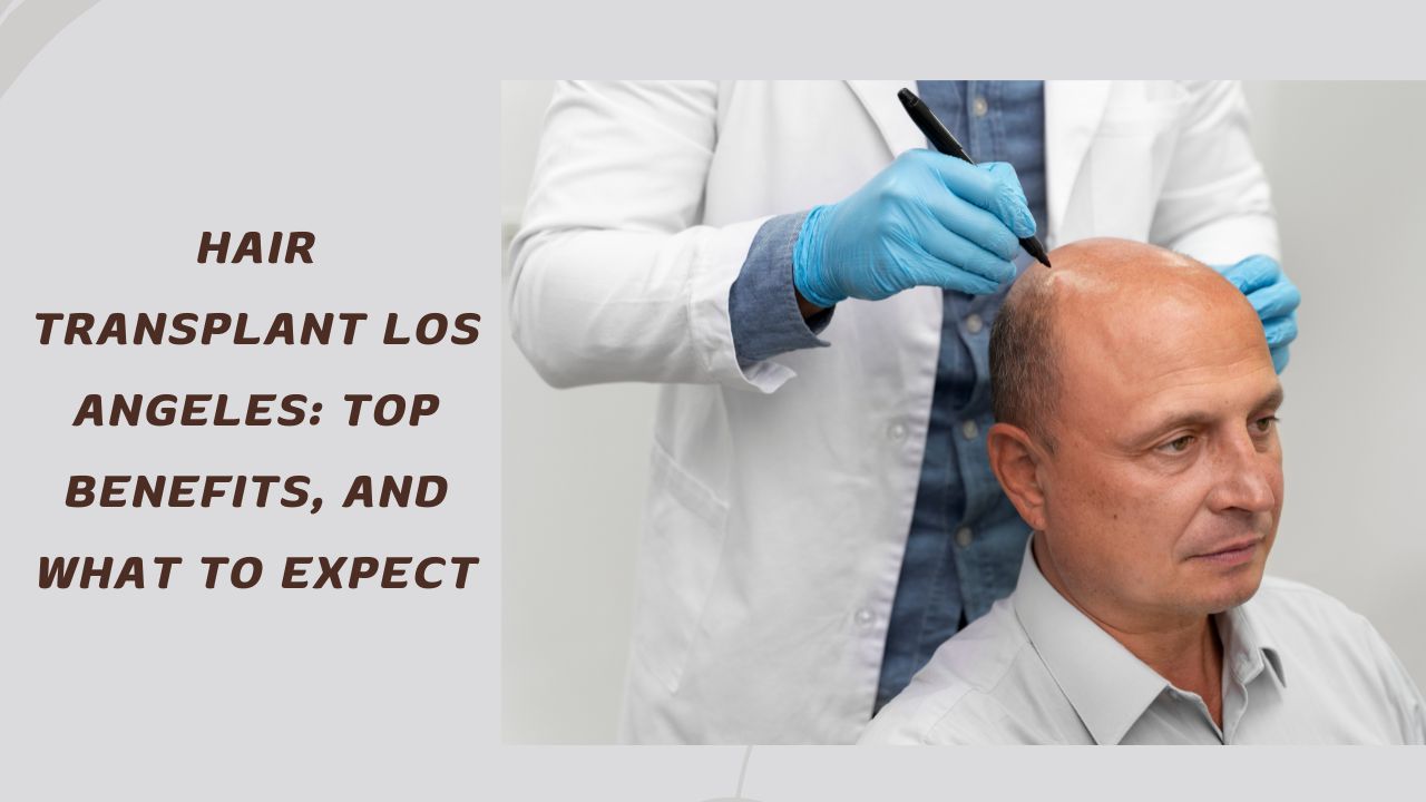Hair Transplant Los Angeles: Top Benefits, and What to Expect