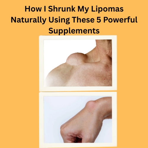 How I Shrunk My Lipomas Naturally