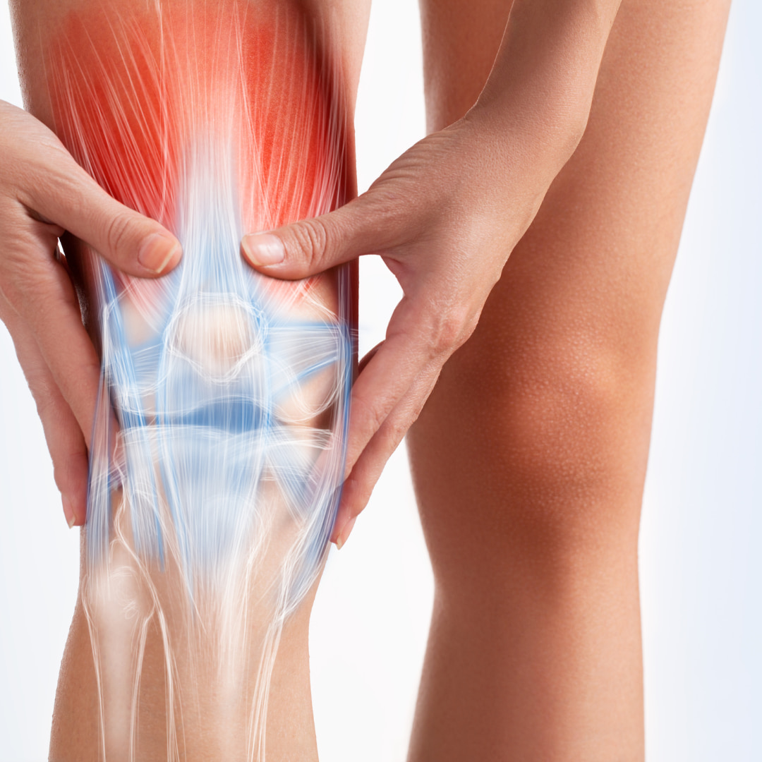 Knee Osteoarthritis
