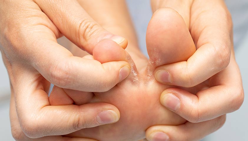How to Prevent Foot Infections with Proper Care Edinburgh
