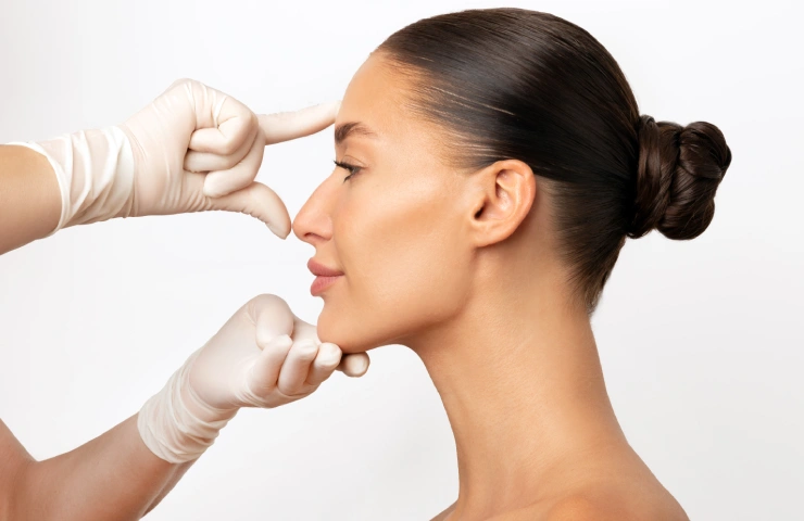 rhinoplasty