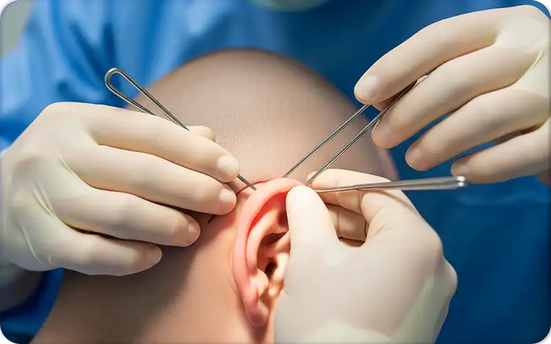 otoplasty surgery in dubai