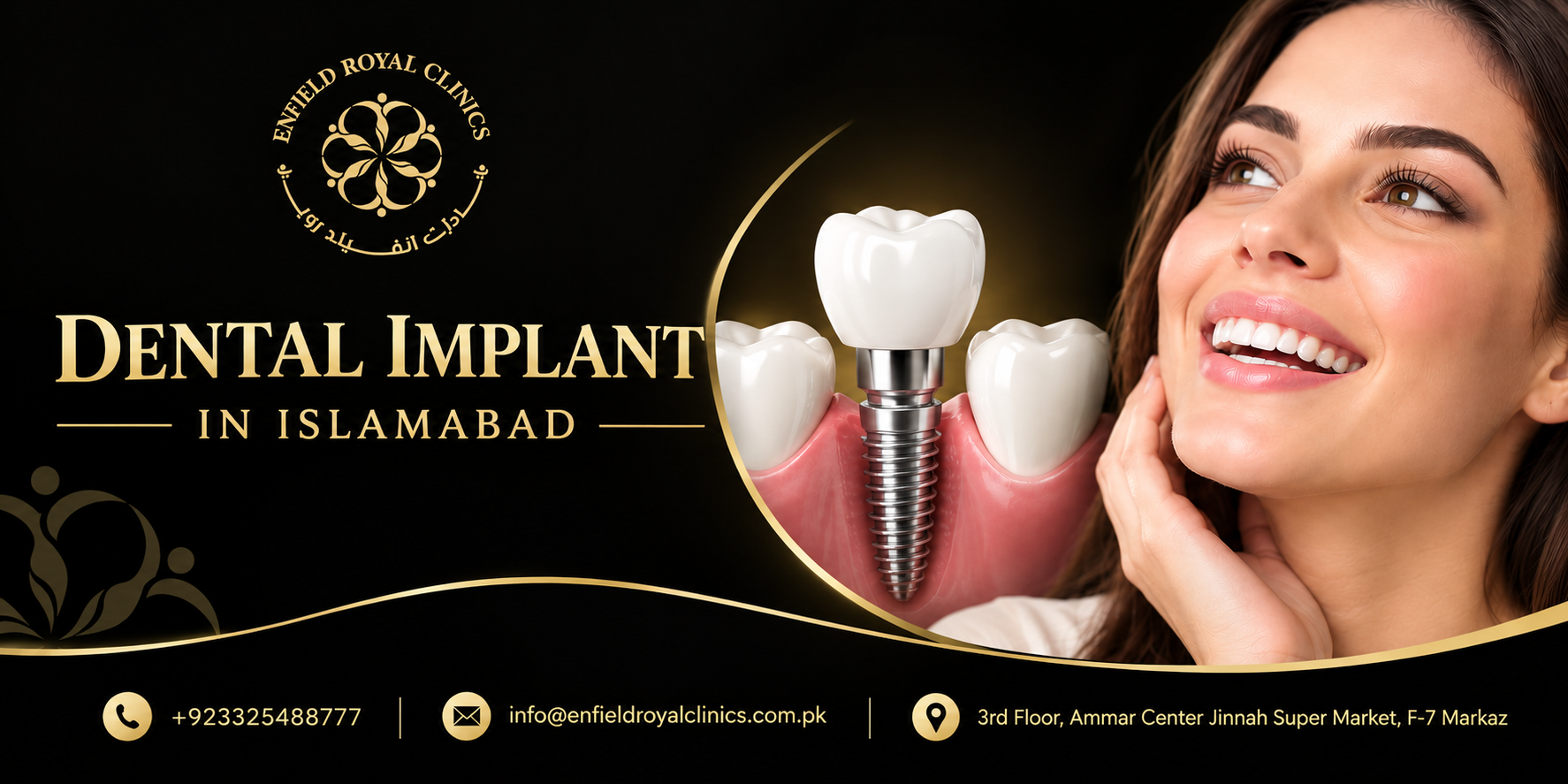 dental implant in islamabad (2)