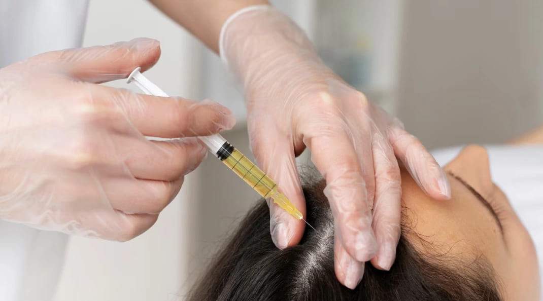 GFC Treatment: A Modern Approach to Hair Fall and Hair Regrowth