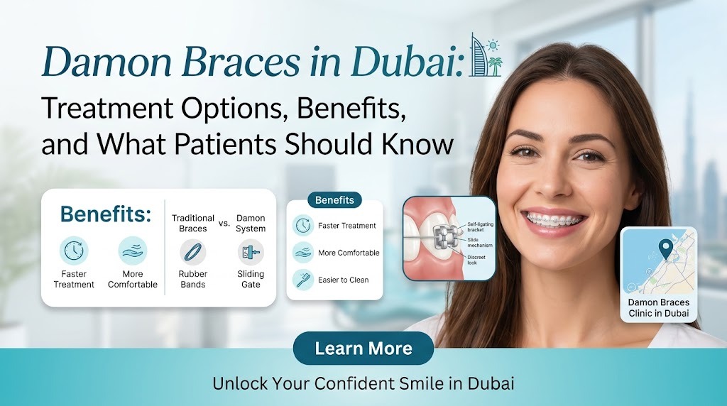 Damon Braces in Dubai